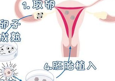 2026泰国试管婴儿的费用是多少钱？费用明细公布！