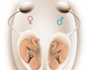 快绝经了主要有哪些症状？四大现象是绝经征兆！