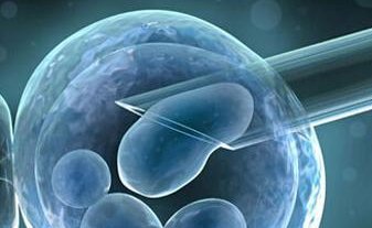 四川做第二代试管婴儿需要多少钱？如何避免试管婴儿的风险？